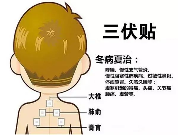 2、三伏貼的功能和功效是什么？
